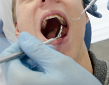 歯科治療中の男性